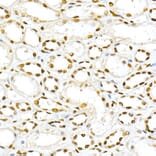 Immunohistochemistry - Anti-SMAD5 (phospho Ser463 + Ser465) Antibody (A308813) - Antibodies.com