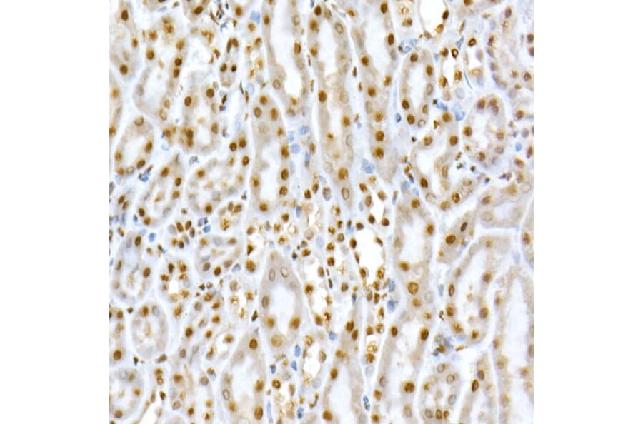 Immunohistochemistry - Anti-SMAD5 (phospho Ser463 + Ser465) Antibody (A308813) - Antibodies.com