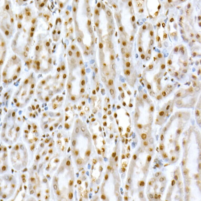 Immunohistochemistry - Anti-SMAD5 (phospho Ser463 + Ser465) Antibody (A308813) - Antibodies.com