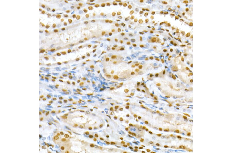 Immunohistochemistry - Anti-SMAD5 (phospho Ser463 + Ser465) Antibody (A308813) - Antibodies.com
