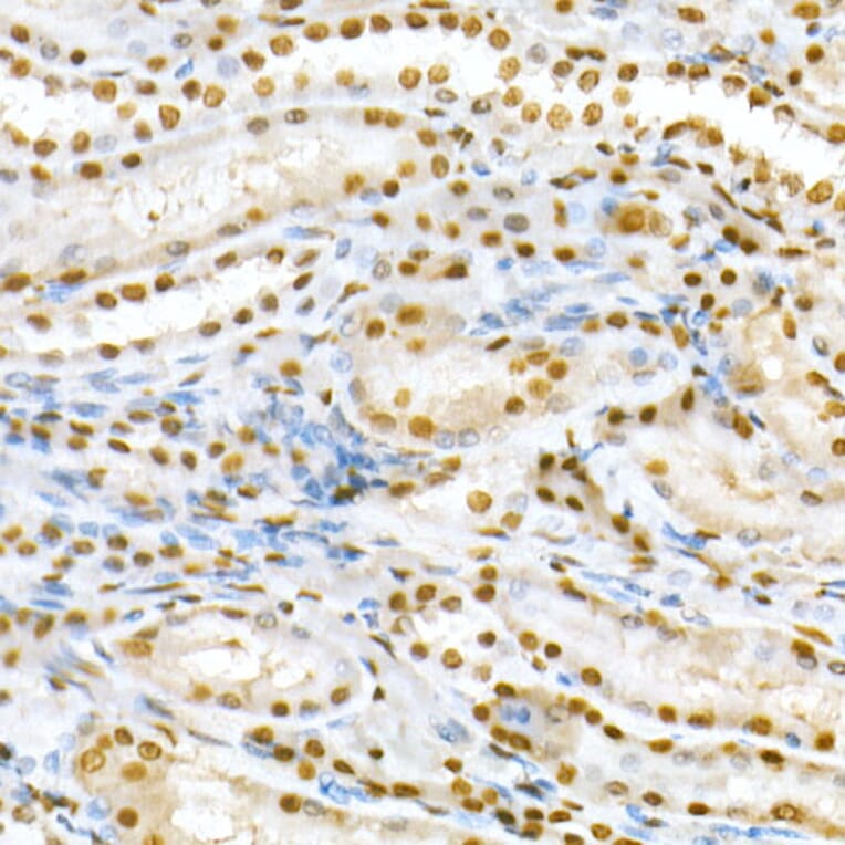 Immunohistochemistry - Anti-SMAD5 (phospho Ser463 + Ser465) Antibody (A308813) - Antibodies.com