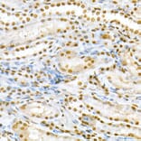 Immunohistochemistry - Anti-SMAD5 (phospho Ser463 + Ser465) Antibody (A308813) - Antibodies.com