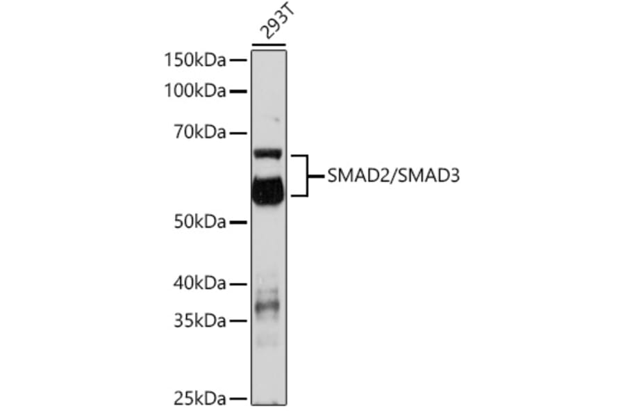Western Blot - Anti-Smad2 + Smad3 Antibody (A308814) - Antibodies.com