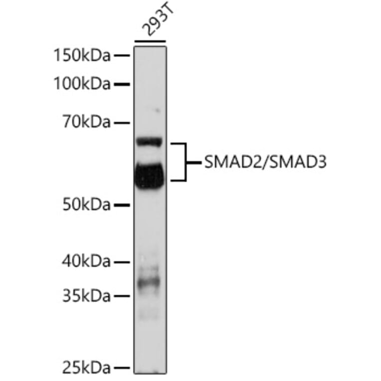 Western Blot - Anti-Smad2 + Smad3 Antibody (A308814) - Antibodies.com
