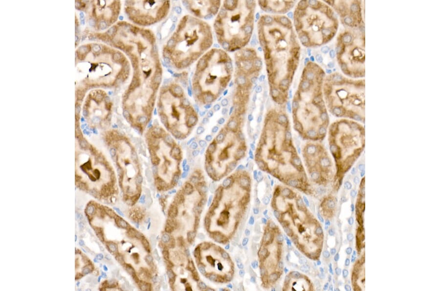 Immunohistochemistry - Anti-PDK1 Antibody [ARC52376] (A308815) - Antibodies.com
