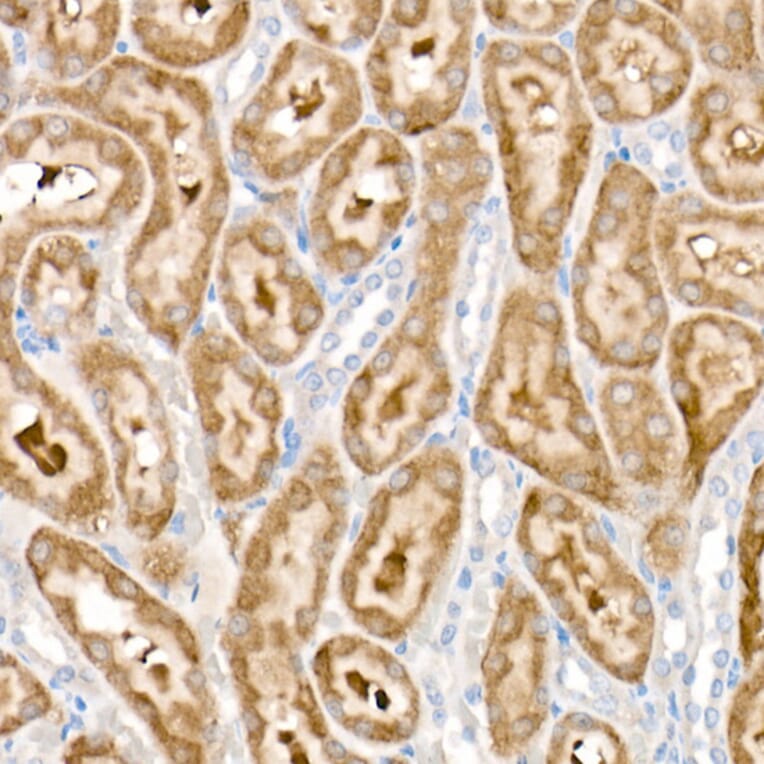 Immunohistochemistry - Anti-PDK1 Antibody [ARC52376] (A308815) - Antibodies.com