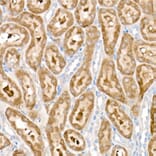 Immunohistochemistry - Anti-PDK1 Antibody [ARC52376] (A308815) - Antibodies.com