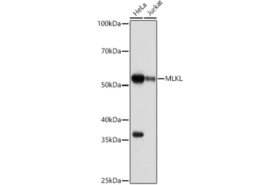 Western Blot - Anti-MLKL Antibody [ARC0165] (A308816) - Antibodies.com
