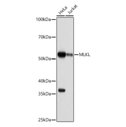 Western Blot - Anti-MLKL Antibody [ARC0165] (A308816) - Antibodies.com