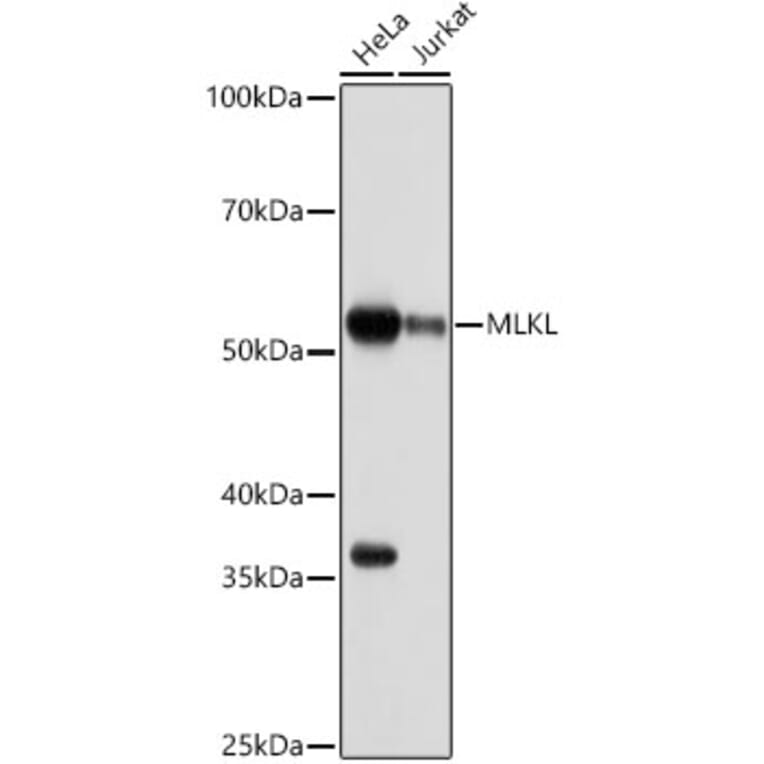 Western Blot - Anti-MLKL Antibody [ARC0165] (A308816) - Antibodies.com