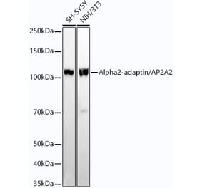 Western Blot - Anti-alpha Adaptin Antibody [ARC54447] (A308819) - Antibodies.com