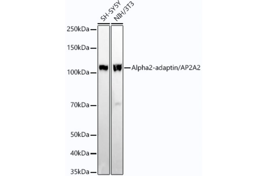 Western Blot - Anti-alpha Adaptin Antibody [ARC54447] (A308819) - Antibodies.com