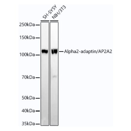 Western Blot - Anti-alpha Adaptin Antibody [ARC54447] (A308819) - Antibodies.com