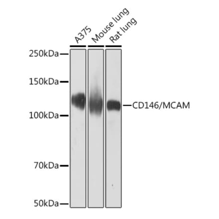 Western Blot - Anti-CD146 Antibody [ARC1708] (A308820) - Antibodies.com