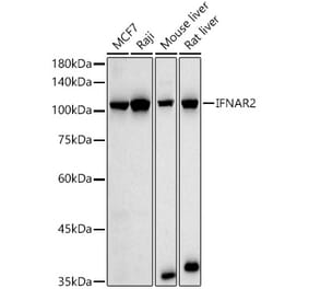 Western Blot - Anti-IFNAR2 Antibody (A308822) - Antibodies.com