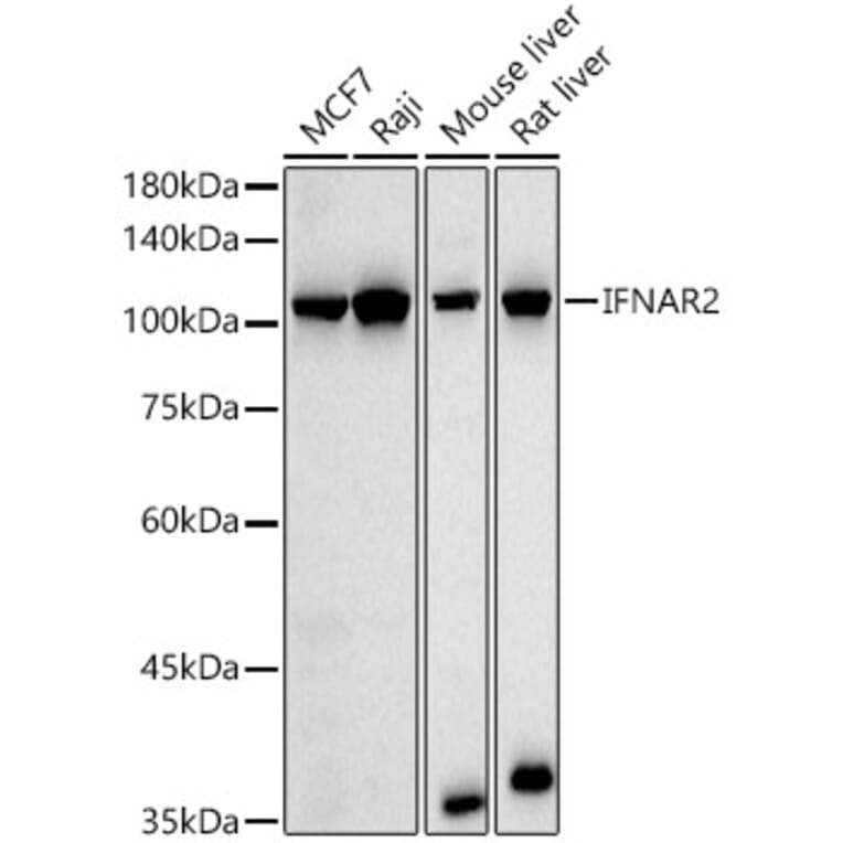 Western Blot - Anti-IFNAR2 Antibody (A308822) - Antibodies.com