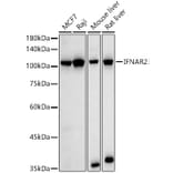 Western Blot - Anti-IFNAR2 Antibody (A308822) - Antibodies.com