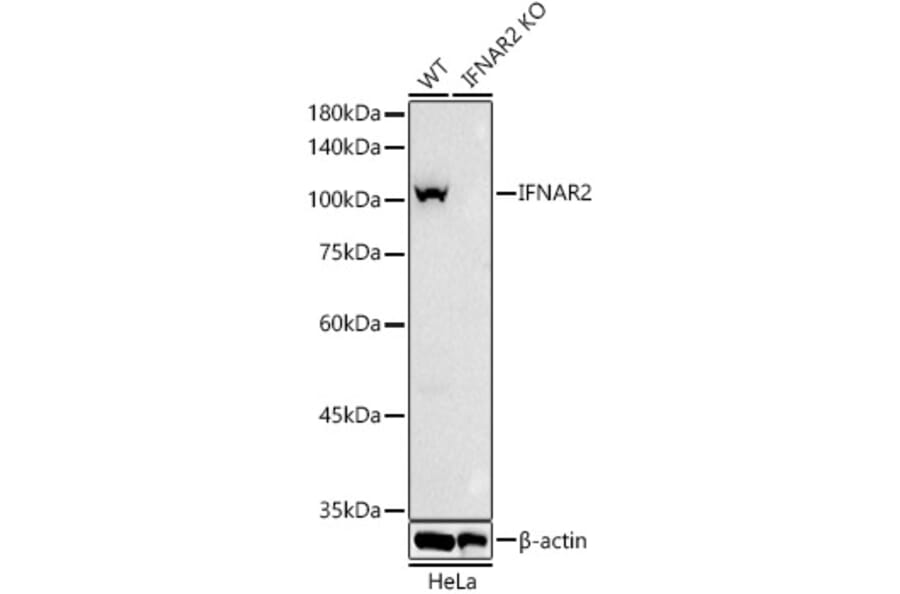 Western Blot - Anti-IFNAR2 Antibody (A308822) - Antibodies.com