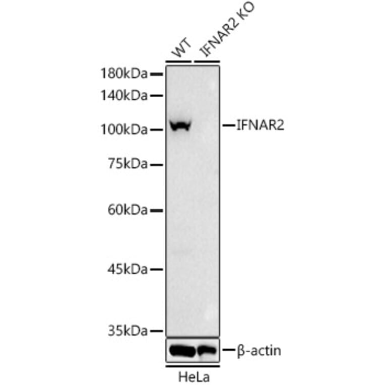 Western Blot - Anti-IFNAR2 Antibody (A308822) - Antibodies.com