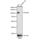 Western Blot - Anti-IFNAR2 Antibody (A308822) - Antibodies.com