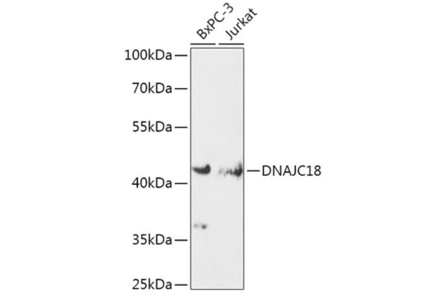 Western Blot - Anti-DNAJC18 Antibody (A308823) - Antibodies.com