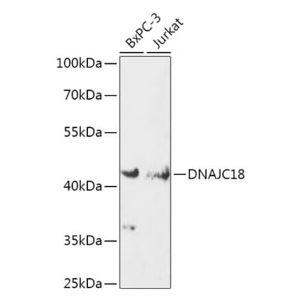 Western Blot - Anti-DNAJC18 Antibody (A308823) - Antibodies.com