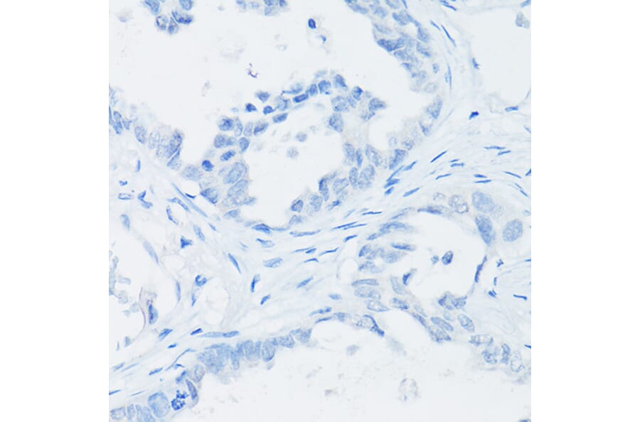 Immunohistochemistry - Anti-Thyroglobulin Antibody [ARC1971] (A308824) - Antibodies.com