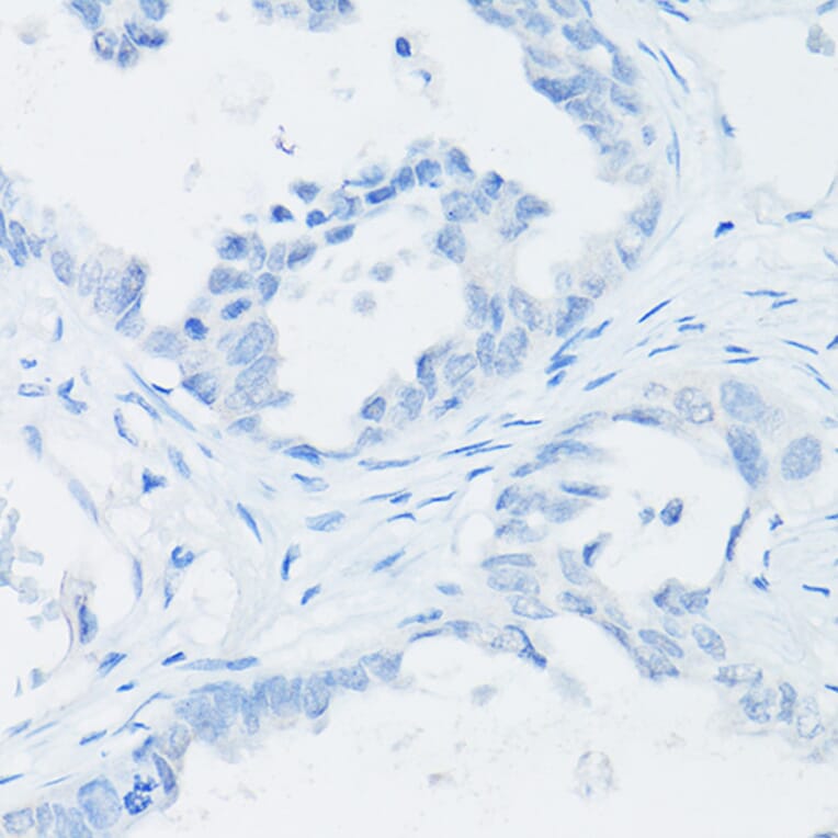 Immunohistochemistry - Anti-Thyroglobulin Antibody [ARC1971] (A308824) - Antibodies.com