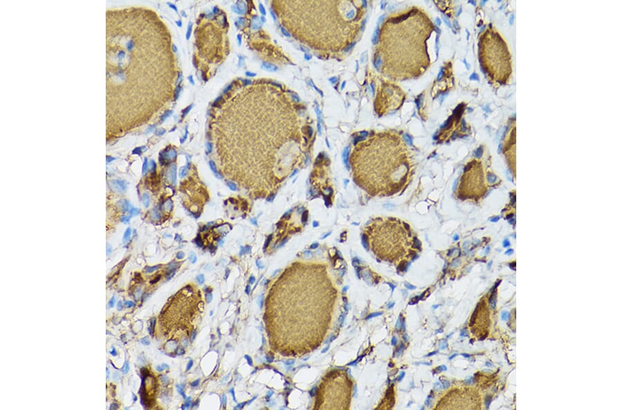 Immunohistochemistry - Anti-Thyroglobulin Antibody [ARC1971] (A308824) - Antibodies.com