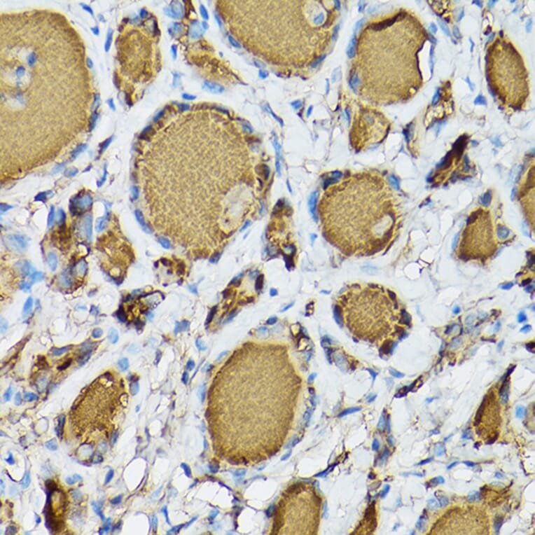 Immunohistochemistry - Anti-Thyroglobulin Antibody [ARC1971] (A308824) - Antibodies.com