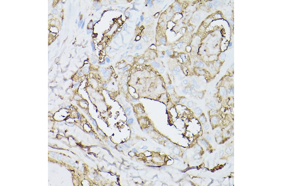 Immunohistochemistry - Anti-Thyroglobulin Antibody [ARC1971] (A308824) - Antibodies.com