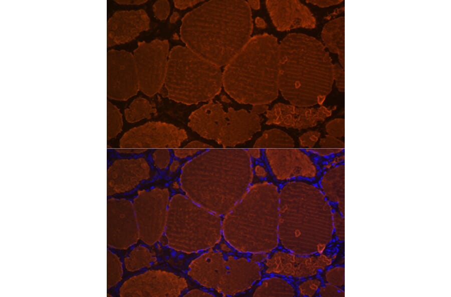 Immunofluorescence - Anti-Thyroglobulin Antibody [ARC1971] (A308824) - Antibodies.com