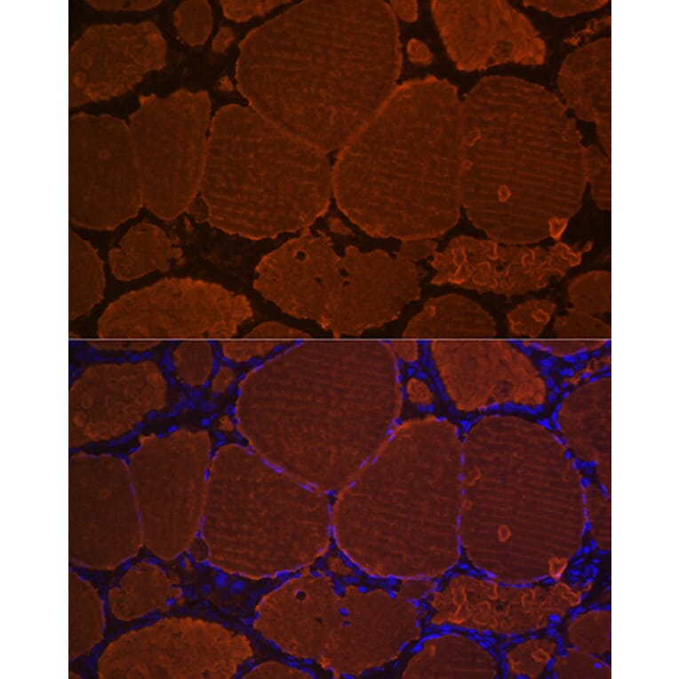Immunofluorescence - Anti-Thyroglobulin Antibody [ARC1971] (A308824) - Antibodies.com