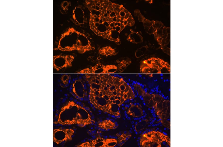 Immunofluorescence - Anti-Thyroglobulin Antibody [ARC1971] (A308824) - Antibodies.com