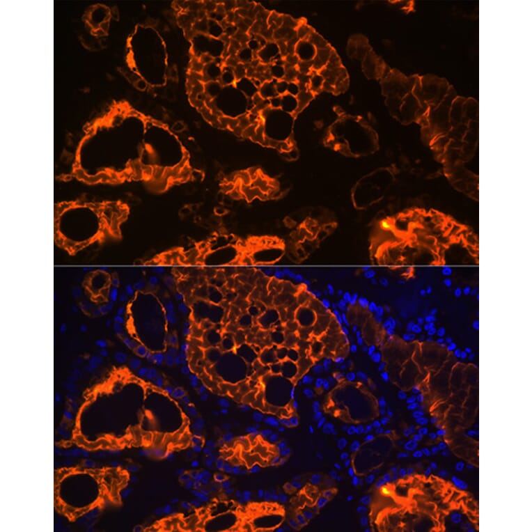 Immunofluorescence - Anti-Thyroglobulin Antibody [ARC1971] (A308824) - Antibodies.com