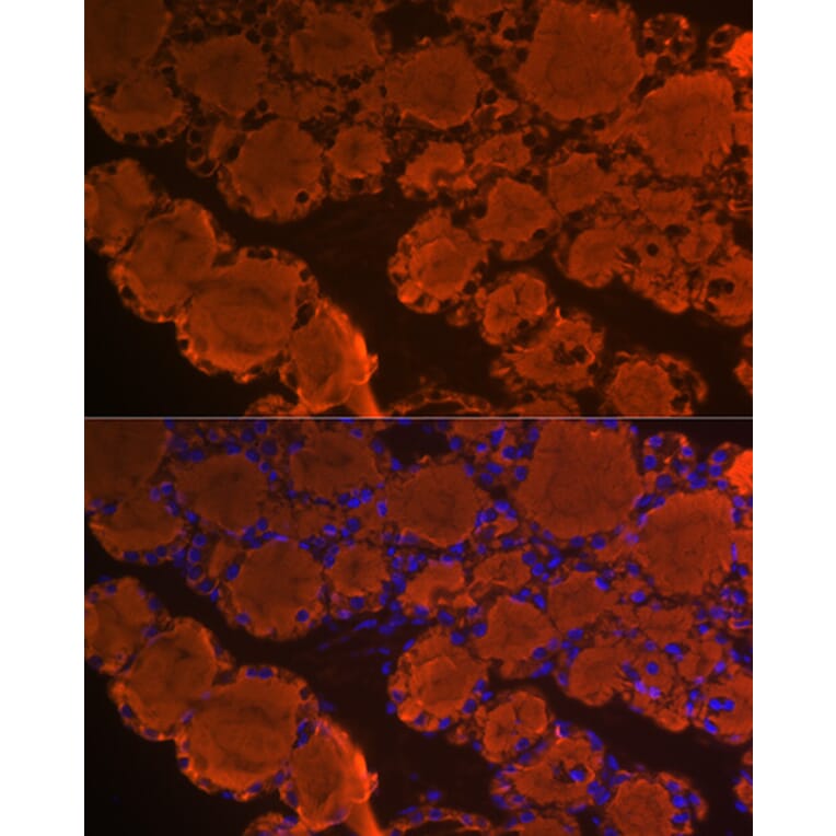 Immunofluorescence - Anti-Thyroglobulin Antibody [ARC1971] (A308824) - Antibodies.com