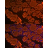 Immunofluorescence - Anti-Thyroglobulin Antibody [ARC1971] (A308824) - Antibodies.com