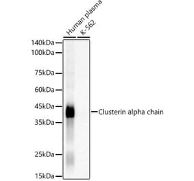 Western Blot - Anti-Clusterin Antibody [ARC52367] (A308825) - Antibodies.com
