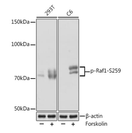 Western Blot - Anti-Raf1 (phospho Ser259) Antibody [ARC1557] (A308827) - Antibodies.com