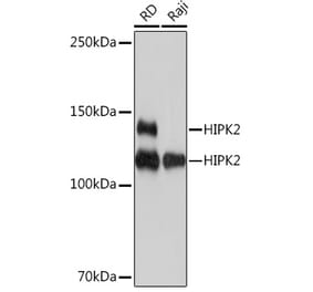 Western Blot - Anti-HIPK2 Antibody [ARC1631] (A308828) - Antibodies.com