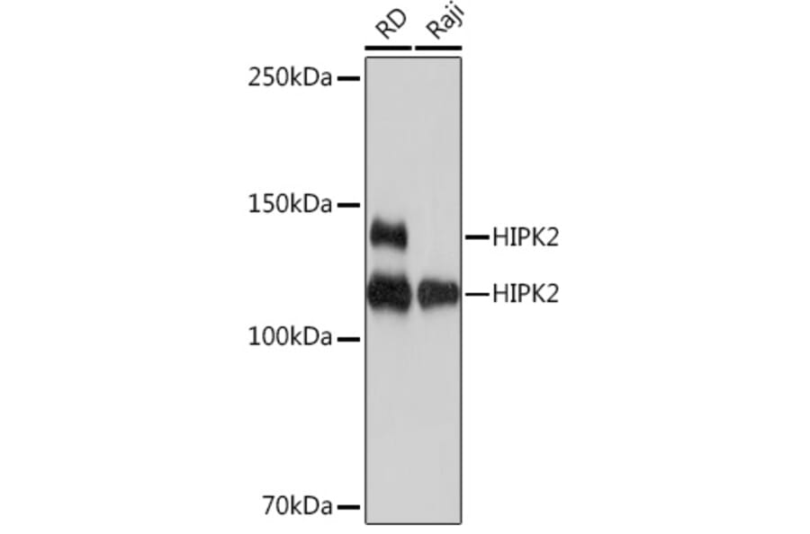 Western Blot - Anti-HIPK2 Antibody [ARC1631] (A308828) - Antibodies.com