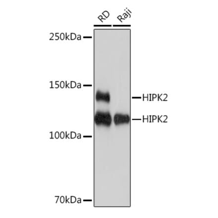 Western Blot - Anti-HIPK2 Antibody [ARC1631] (A308828) - Antibodies.com