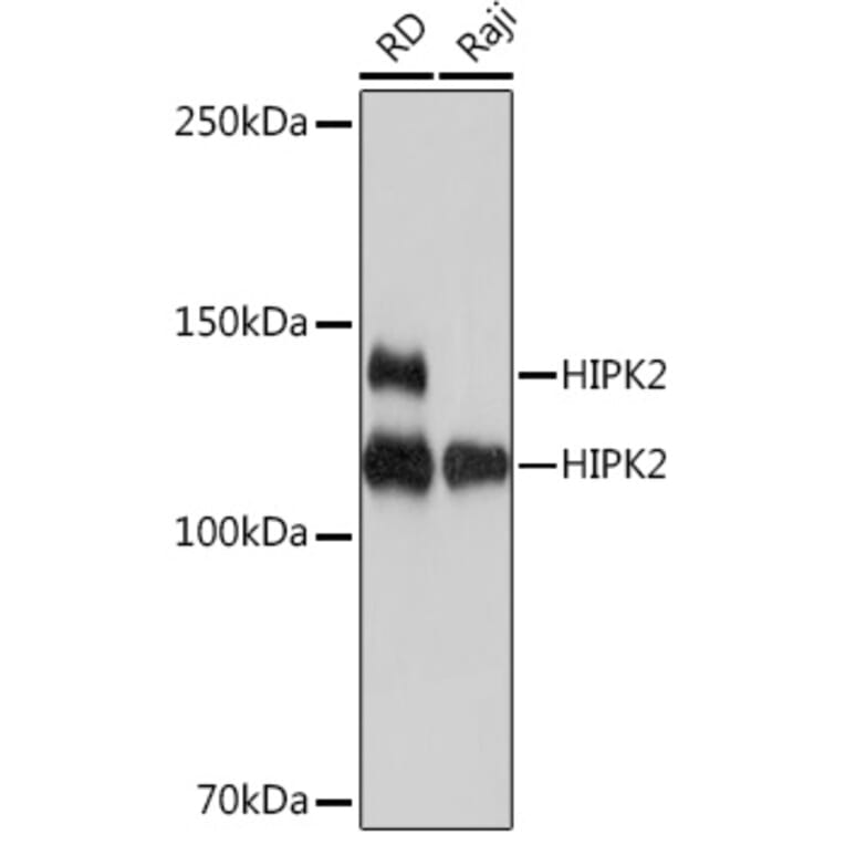 Western Blot - Anti-HIPK2 Antibody [ARC1631] (A308828) - Antibodies.com