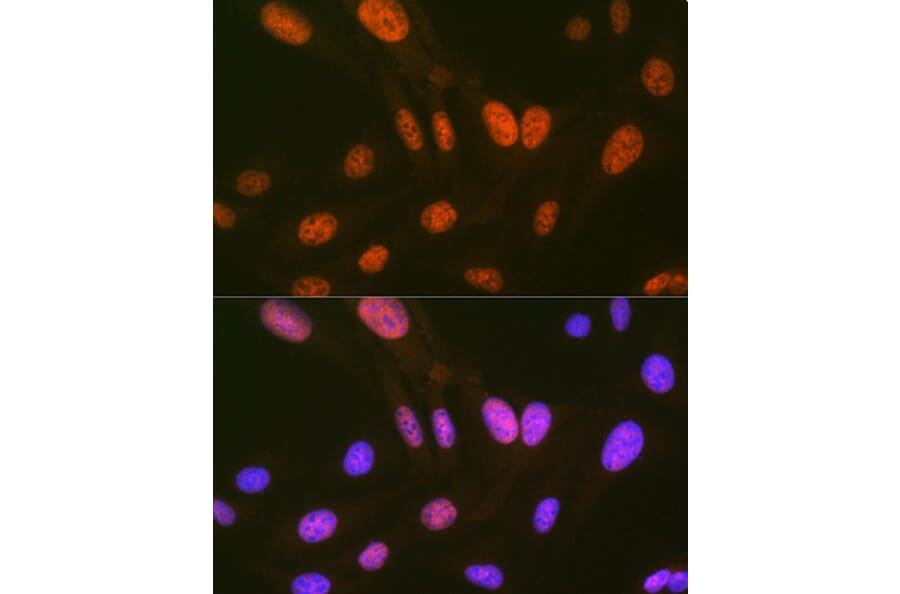 Immunofluorescence - Anti-HIPK2 Antibody [ARC1631] (A308828) - Antibodies.com
