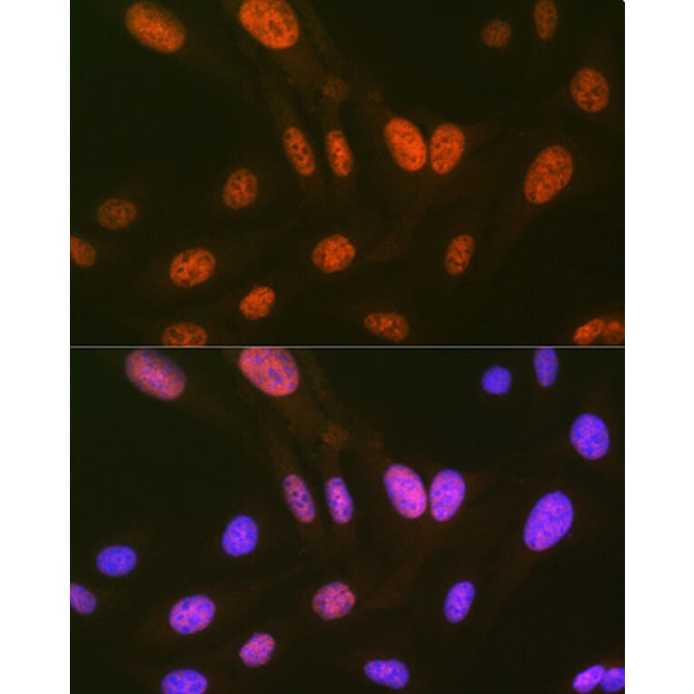 Immunofluorescence - Anti-HIPK2 Antibody [ARC1631] (A308828) - Antibodies.com