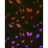 Immunofluorescence - Anti-HIPK2 Antibody [ARC1631] (A308828) - Antibodies.com