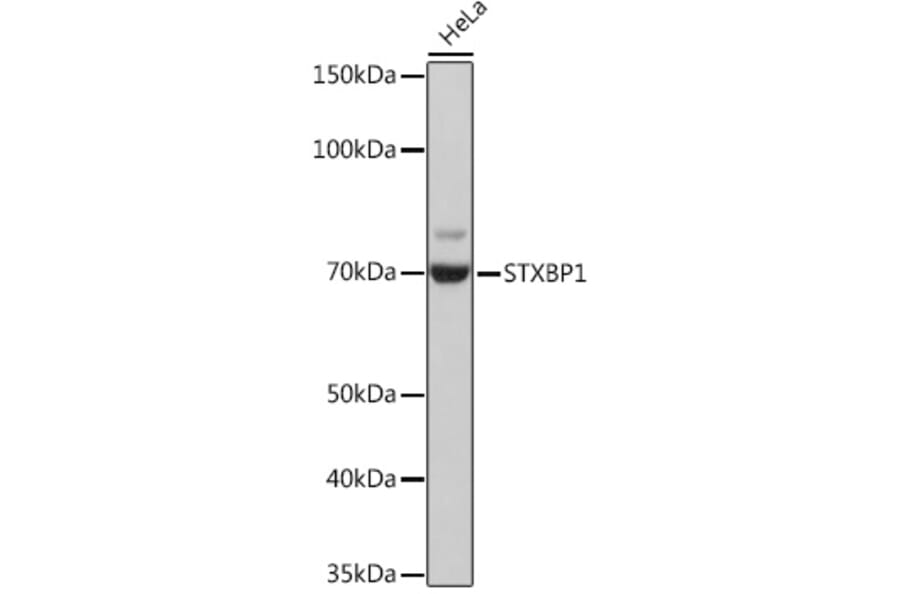 Western Blot - Anti-Munc18-1 Antibody [ARC1518] (A308829) - Antibodies.com