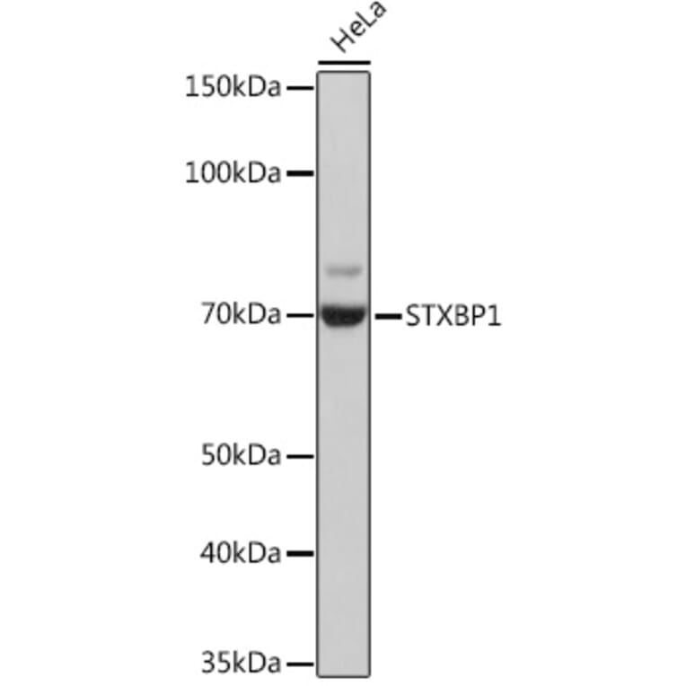 Western Blot - Anti-Munc18-1 Antibody [ARC1518] (A308829) - Antibodies.com