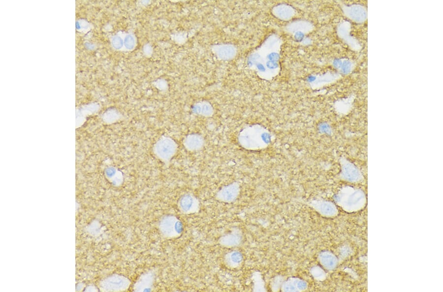 Immunohistochemistry - Anti-Munc18-1 Antibody [ARC1518] (A308829) - Antibodies.com