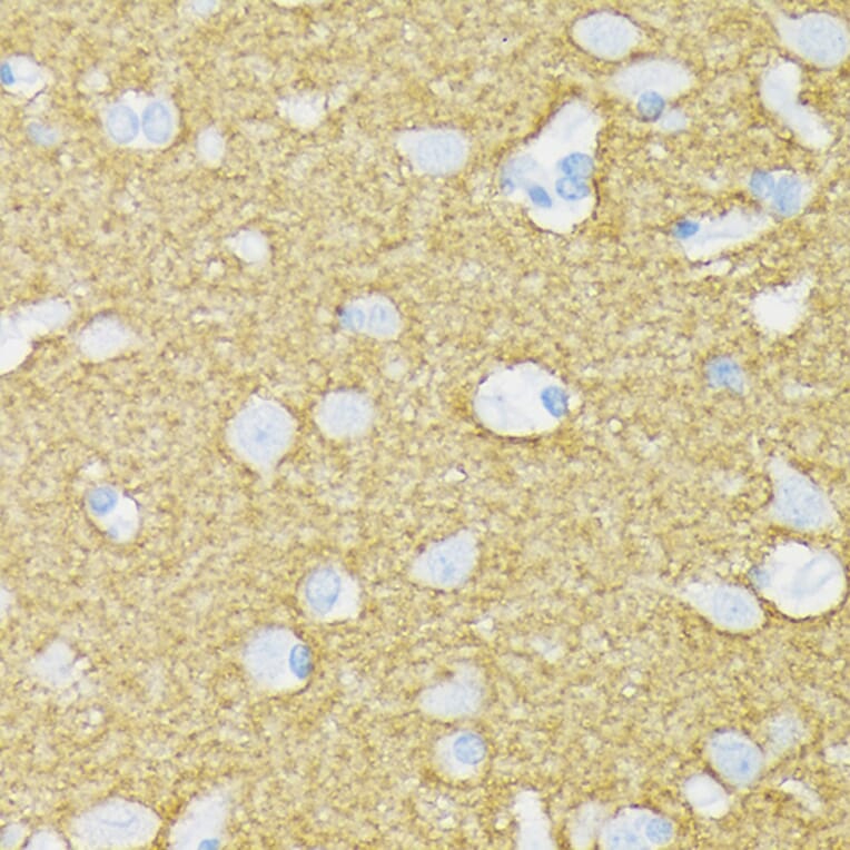 Immunohistochemistry - Anti-Munc18-1 Antibody [ARC1518] (A308829) - Antibodies.com